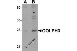 Western Blotting (WB) image for anti-Golgi phosphoprotein 3 (Coat-Protein) (GOLPH3) (N-Term) antibody (ABIN1031394) (GOLPH3 Antikörper  (N-Term))