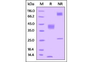 Human Latent TGFB1, His Tag on SDS-PAGE under reducing (R) and no-reducing (NR) conditions.