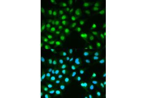 Immunofluorescence analysis of HeLa cell using PPP3CA antibody. (PPP3CA Antikörper)