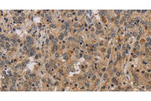 Immunohistochemistry (Paraffin-embedded Sections) (IHC (p)) image for anti-ELAV (Embryonic Lethal, Abnormal Vision, Drosophila)-Like 2 (Hu Antigen B) (ELAVL2) antibody (ABIN7243517)