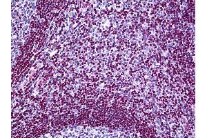 Anti-MECP2 antibody IHC of human tonsil. (MECP2 Antikörper  (AA 81-170))