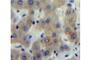 Used in DAB staining on fromalin fixed paraffin-embedded Liver tissue (FCN1 Antikörper  (AA 25-317))