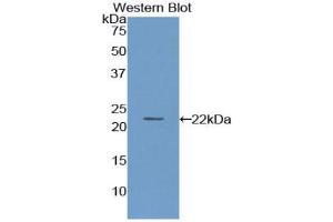 Western blot analysis of the recombinant protein. (PON1 Antikörper  (AA 2-186))