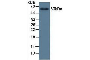 Detection of MMP19 in Human Serum using Polyclonal Antibody to Matrix Metalloproteinase 19 (MMP19) (MMP19 Antikörper  (AA 98-508))