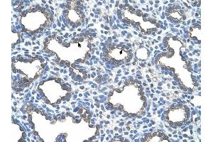 UBE2D2 antibody was used for immunohistochemistry at a concentration of 4-8 ug/ml to stain Alveolar cells (arrows) in Human Lung. (UBE2D2 Antikörper)
