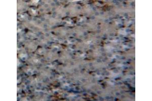 Used in DAB staining on fromalin fixed paraffin-embedded kidney tissue (PIN1 Antikörper  (AA 2-165))