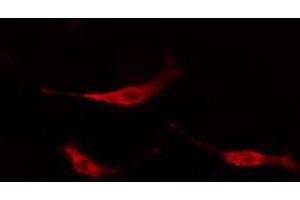 ABIN6267670 staining NIH-3T3 cells by IF/ICC. (TRKB Antikörper  (pTyr706))