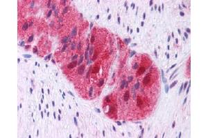 Immunohistochemistry (Paraffin-embedded Sections) (IHC (p)) image for anti-Growth Factor Receptor-Bound Protein 2 (GRB2) (AA 198-217), (C-Term) antibody (ABIN615588)