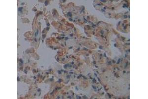 IHC-P analysis of Human Tissue, with DAB staining. (FGL2 Antikörper  (AA 24-439))