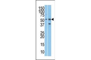 The anti-R Pab (ABIN388684 and ABIN2838672) is used in Western blot to detect R in T47D (left) and Jurkat (right) cell line lysates. (URI1 Antikörper  (C-Term))