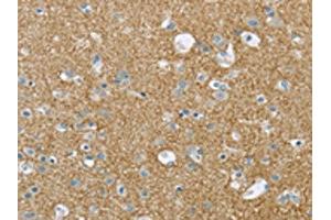 The image on the left is immunohistochemistry of paraffin-embedded Human brain tissue using ABIN7193008(VAMP2 Antibody) at dilution 1/20, on the right is treated with synthetic peptide. (VAMP2 Antikörper)