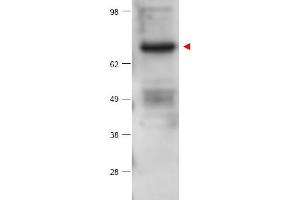 Image no. 1 for anti-Protein Kinase C, beta (PRKCB) (Internal Region) antibody (ABIN401431) (PKC beta Antikörper  (Internal Region))