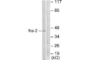 Western blot analysis of extracts from LOVO cells, using Fra-2 antibody (#C0197). (FOSL2 Antikörper)