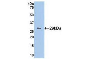 Detection of Recombinant IkBe, Human using Polyclonal Antibody to Inhibitory Subunit Of NF Kappa B Epsilon (IkBe) (Inhibitory Subunit of NF-KappaB epsilon (AA 207-440) Antikörper)