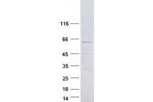 Western Blotting (WB) image for F-Box Protein 33 (FBXO33) protein (Myc-DYKDDDDK Tag) (ABIN2720956)
