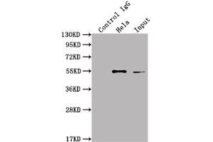 Immunoprecipitating ILK in Hela whole cell lysate Lane 1: Rabbit control IgG instead of ABIN7127572 in Hela whole cell lysate. (Rekombinanter ILK Antikörper)