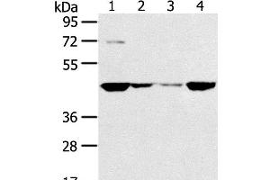 Western Blot analysis of HT-29, 231, hela and A549 cell using SMYD5 Polyclonal Antibody at dilution of 1:200 (SMYD5 Antikörper)