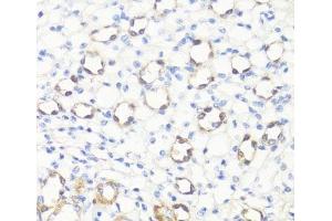 Immunohistochemistry of paraffin-embedded Mouse kidney using SS18L1 Polyclonal Antibody at dilution of 1:100 (40x lens). (SS18L1 Antikörper)