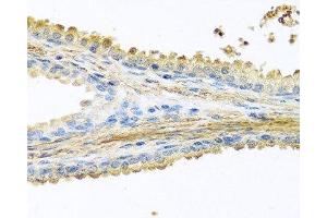 Immunohistochemistry of paraffin-embedded Human prostate using PIP Polyclonal Antibody at dilution of 1:100 (40x lens).