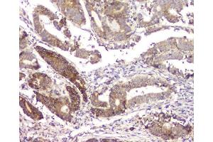 IHC analysis of RMI2 using anti-RMI2 antibody (ABIN6719656).