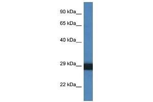 Western Blot showing CTSG antibody used at a concentration of 1 ug/ml against THP-1 Cell Lysate (Cathepsin G Antikörper  (C-Term))