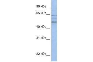 WB Suggested Anti-ZMYND17 Antibody Titration:  0. (ZMYND17 Antikörper  (C-Term))