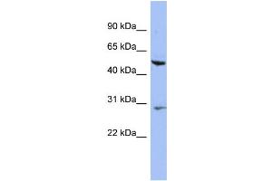 WB Suggested Anti-KRT75 Antibody Titration: 0. (Keratin 75 Antikörper  (N-Term))