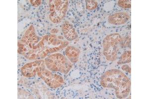 Used in DAB staining on fromalin fixed paraffin- embedded kidney tissue (SP140 Antikörper  (AA 443-655))