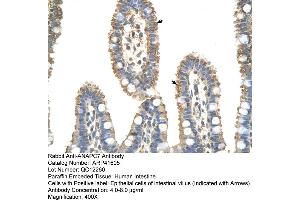 Rabbit Anti-ANAPC7 Antibody  Paraffin Embedded Tissue: Human Intestine Cellular Data: Epithelial cells of intestinal villas Antibody Concentration: 4. (ANAPC7 Antikörper  (C-Term))