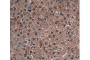 Used in DAB staining on fromalin fixed paraffin- embedded liver tissue (Atrophin 1 Antikörper  (AA 879-1190))