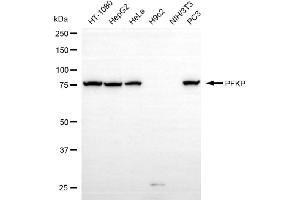 Western blotting analysis using DAPK3 antibody (ABIN7798296).