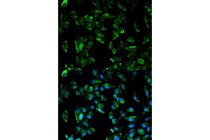 Immunofluorescence analysis of HeLa cells using TPM3 antibody (ABIN5970548). (TPM3 Antikörper)