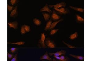 Immunofluorescence analysis of U-2 OS cells using PDE6D Polyclonal Antibody at dilution of 1:100 (40x lens). (PDE6D Antikörper)