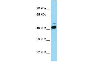 WB Suggested Anti-Rorb Antibody   Titration: 1. (RORB Antikörper  (N-Term))