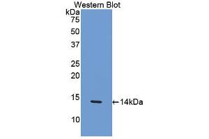 Western blot analysis of the recombinant protein. (CCL4 Antikörper  (AA 24-92))