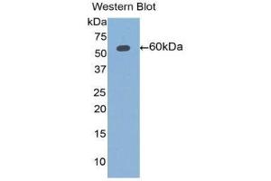Western Blotting (WB) image for anti-Aldehyde Dehydrogenase 7 Family, Member A1 (ALDH7A1) (AA 1-539) antibody (ABIN1077759) (ALDH7A1 Antikörper  (AA 1-539))