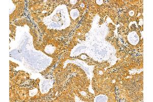 anti-Reticulocalbin 2, EF-Hand Calcium Binding Domain (RCN2) (C-Term) antibody