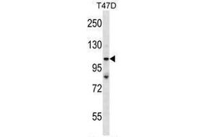Western Blotting (WB) image for anti-Tumor Protein P53 Binding Protein 2 (TP53BP2) (AA 92-122), (N-Term) antibody (ABIN955298)