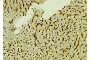 ABIN6276661 at 1/100 staining Mouse liver tissue by IHC-P.