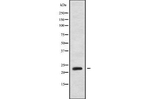 Western blot analysis of PPP1R2P3 using MCF7 whole cell lysates (PPP1R2P3 Antikörper)