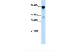 Image no. 1 for anti-Pseudouridylate Synthase 7 Homolog (PUS7) (AA 101-150) antibody (ABIN341308)