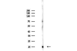 anti-Tumor Protein D52-Like 1 (TPD52L1) (N-Term) antibody