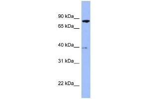 WB Suggested Anti-RDX Antibody Titration: 0. (Radixin Antikörper  (Middle Region))