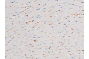 ABIN6267603 at 1/200 staining Mouse heart tissue sections by IHC-P. (PKC theta Antikörper  (pSer676))