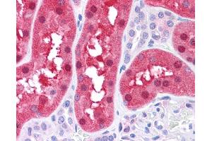 FAH antibody was used for immunohistochemistry at a concentration of 4-8 ug/ml. (FAH Antikörper)