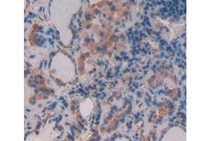 Used in DAB staining on fromalin fixed paraffin- embedded thyroid tissue (ABCB9 Antikörper  (AA 504-766))