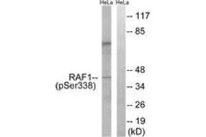 Western blot analysis of extracts from HeLa cells treated with paclitaxel 1uM 24h, using C-RAF (Phospho-Ser338) Antibody. (RAF1 Antikörper  (pSer338))