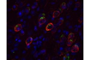 Immunohistochemistry (IHC) image for anti-Amyloid beta (A4) Precursor Protein (APP) (C-Term) antibody (ABIN1742281)