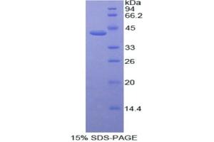 SDS-PAGE analysis of Human ACVR2A Protein.