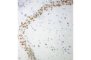Anti-53BP1 antibody, IHC(P) IHC(P): Mouse Brain Tissue (TP53BP1 Antikörper  (C-Term))